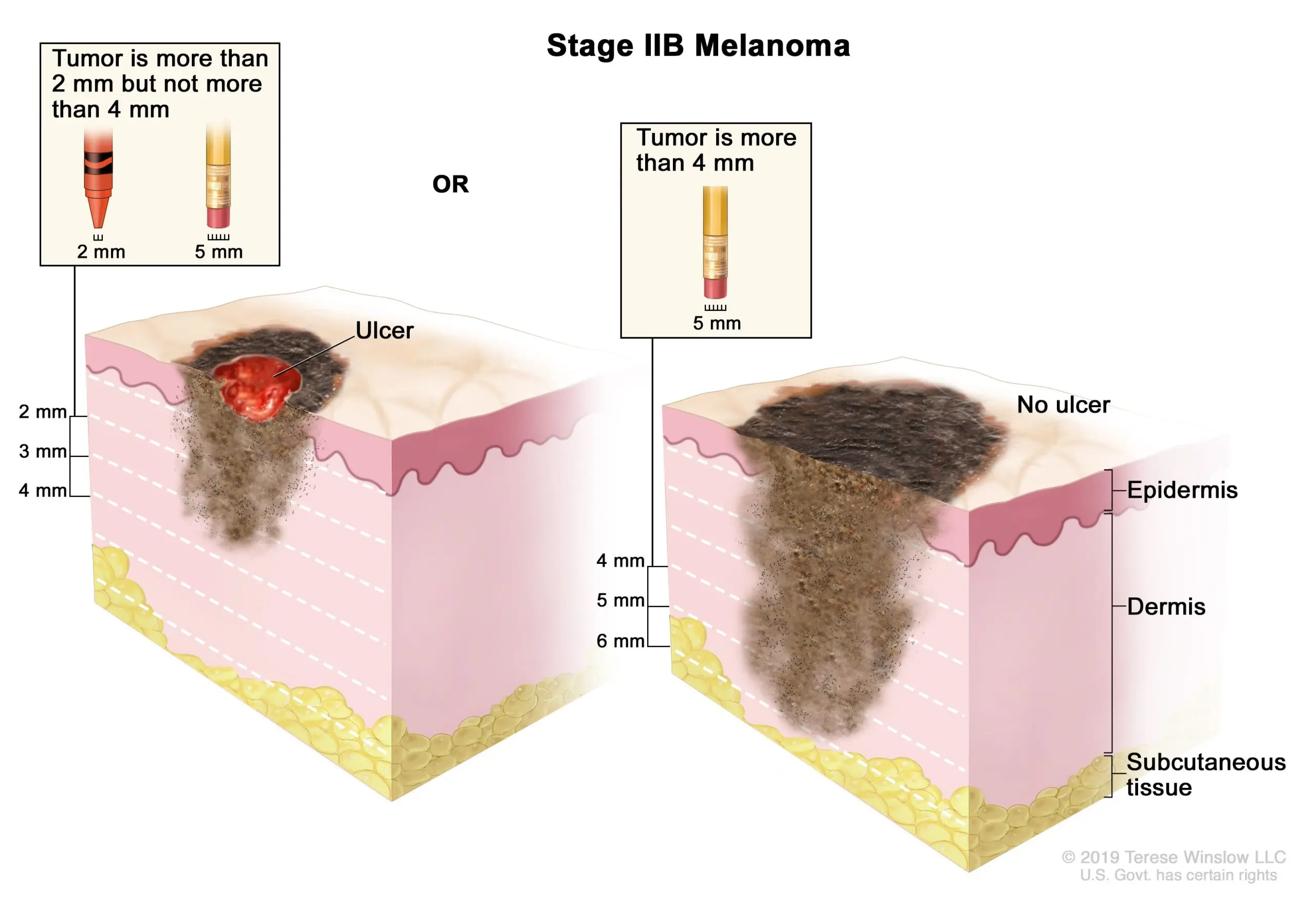 Five common habits that can end up in skin cancer, including melanoma