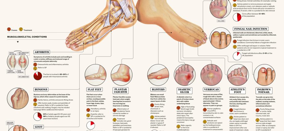 Five diseases that can be seen on the feet