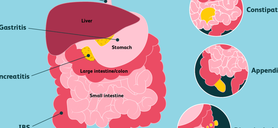 Five signs it&#8217;s not your usual stomach ache. When to see a doctor?