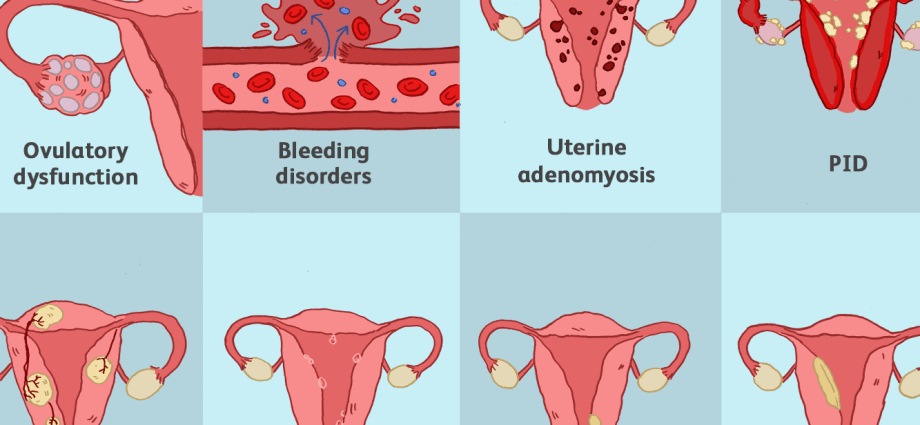 Five unexpected symptoms of menstruation. See if you have them too