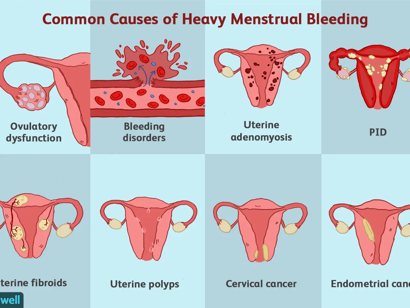 Five unexpected symptoms of menstruation. See if you have them too