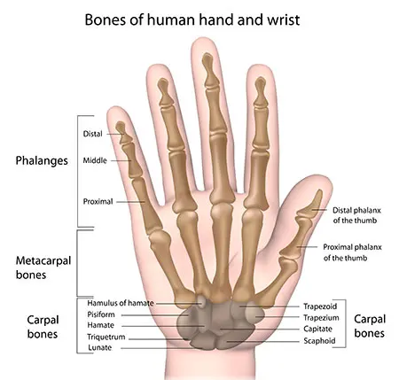 Fractures of the metacarpal bones and fingers