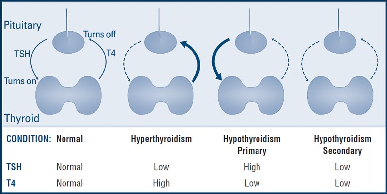 Free thyroid function tests for women