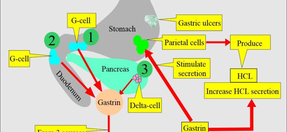 Gastrin &#8211; what is it, when to test, what does elevated gastrin mean?