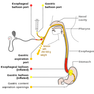 Gastrointestinal haemorrhage