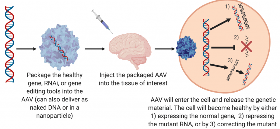 Gene therapy &#8211; what is it and when is it used?