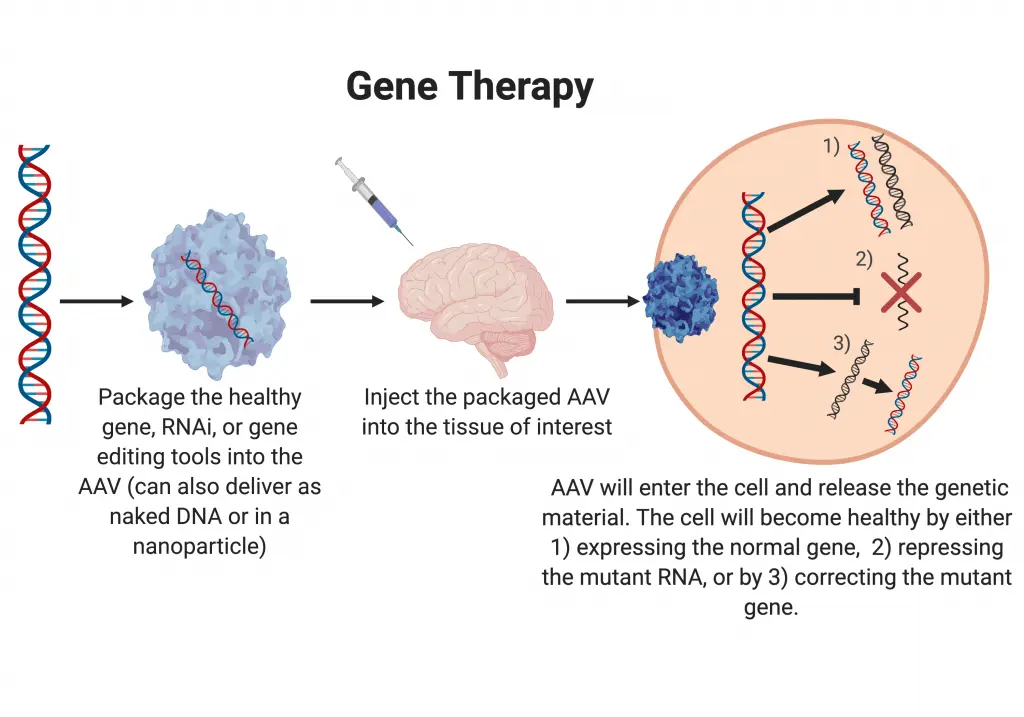 Gene therapy &#8211; what is it and when is it used?