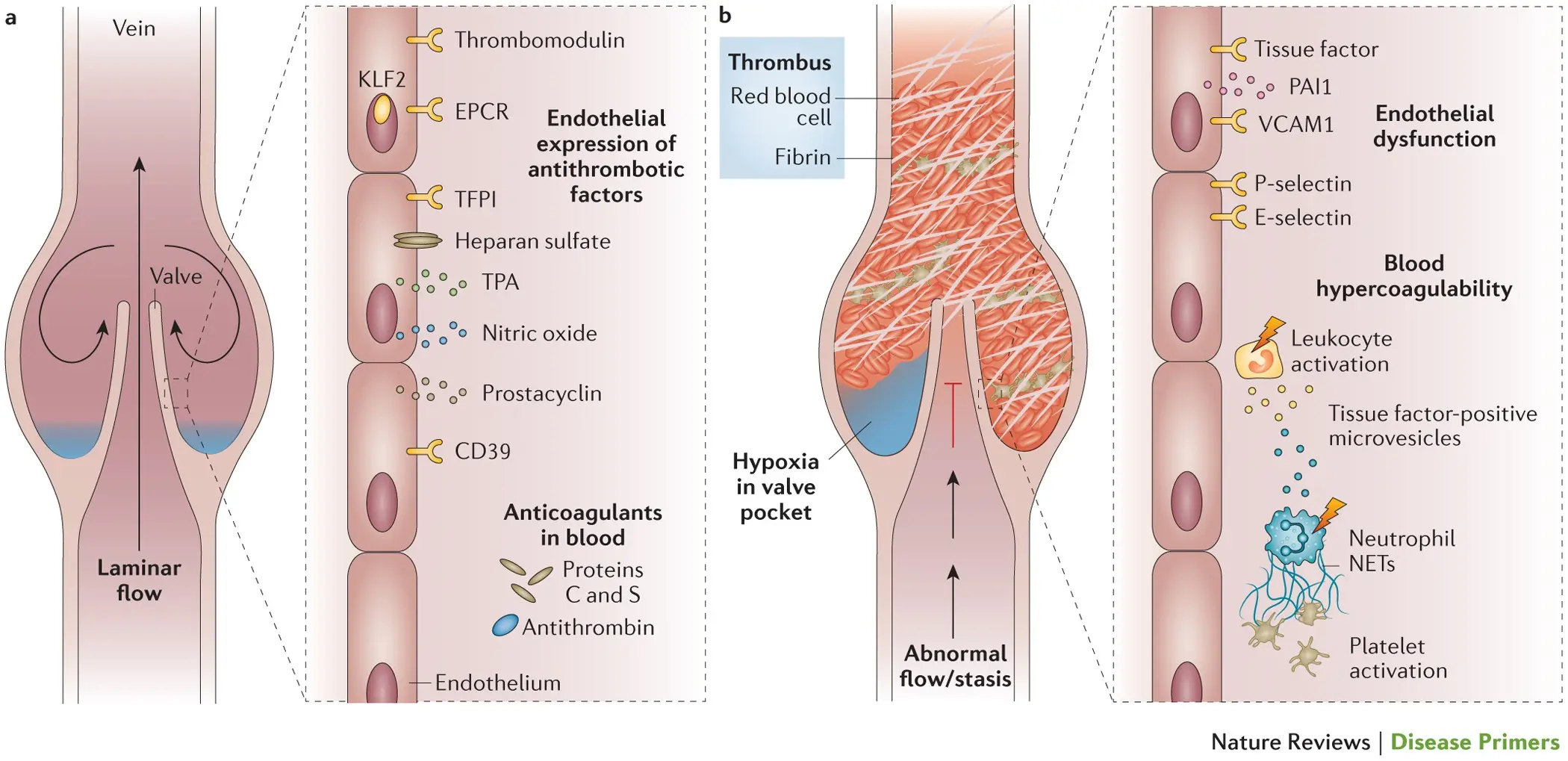 Genetic thrombosis &#8211; mutations, hormone therapies, lifestyle