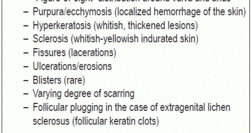 Genital lichen planus &#8211; symptoms and treatment