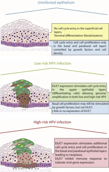 Genital warts &#8211; pathways of infection. What is the treatment of genital warts?