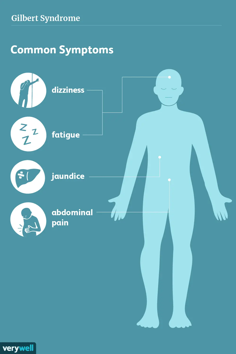 Gilbert&#8217;s syndrome &#8211; symptoms and treatment of hyperbilirubinemia