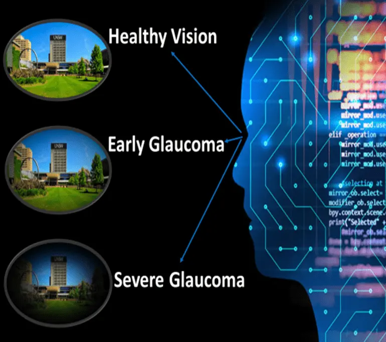 Glaucoma Early Detection Program