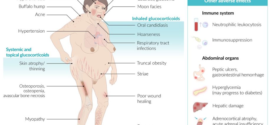 Glucocorticosteroids &#8211; use, side effects