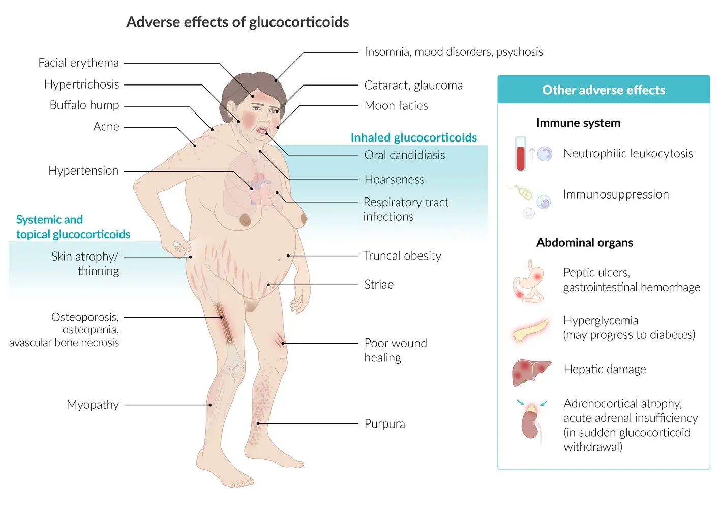 Glucocorticosteroids &#8211; use, side effects