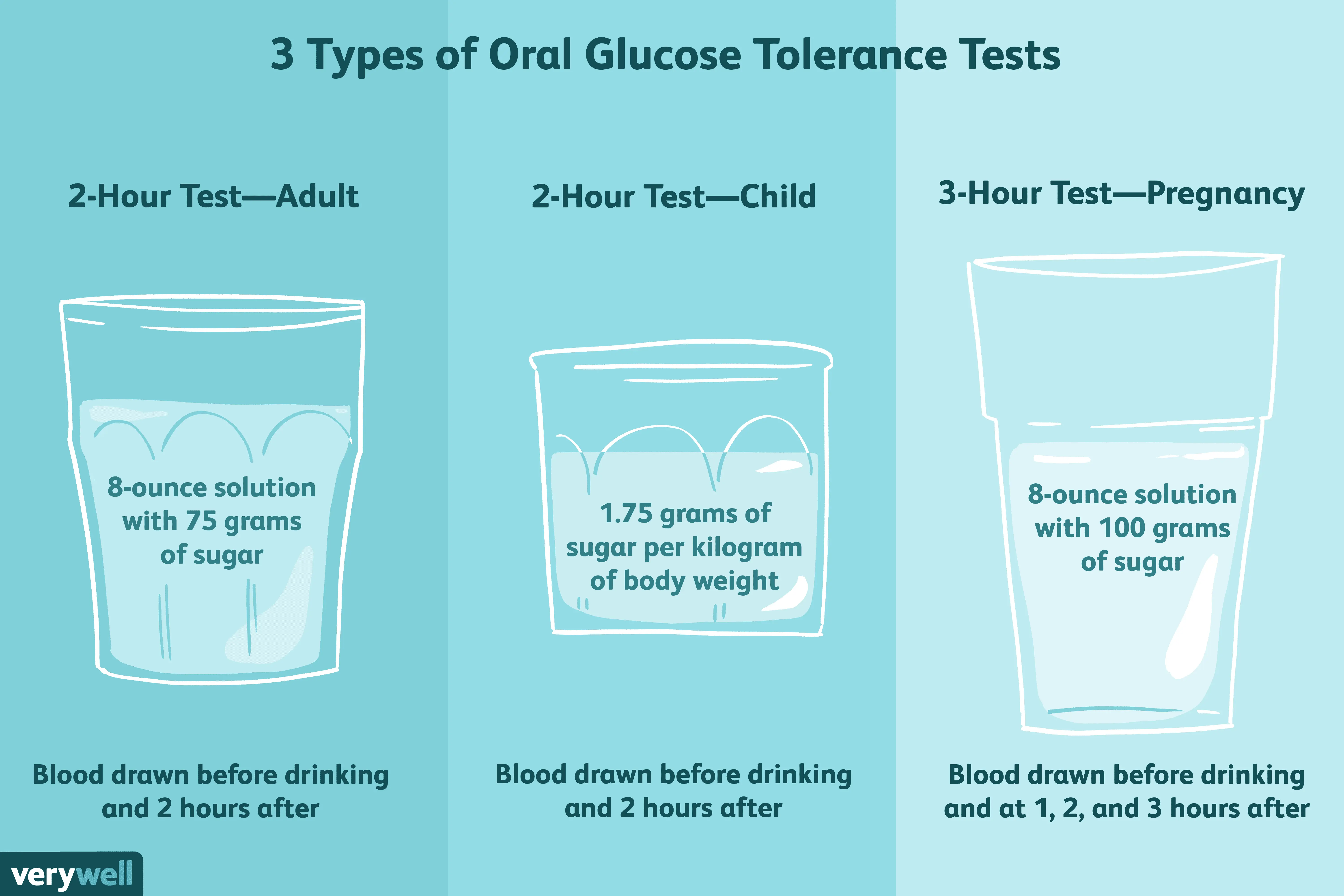 Glucose load test &#8211; what does it look like? Who should do it?