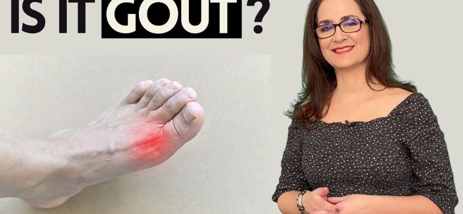 Gout &#8211; everything you need to know