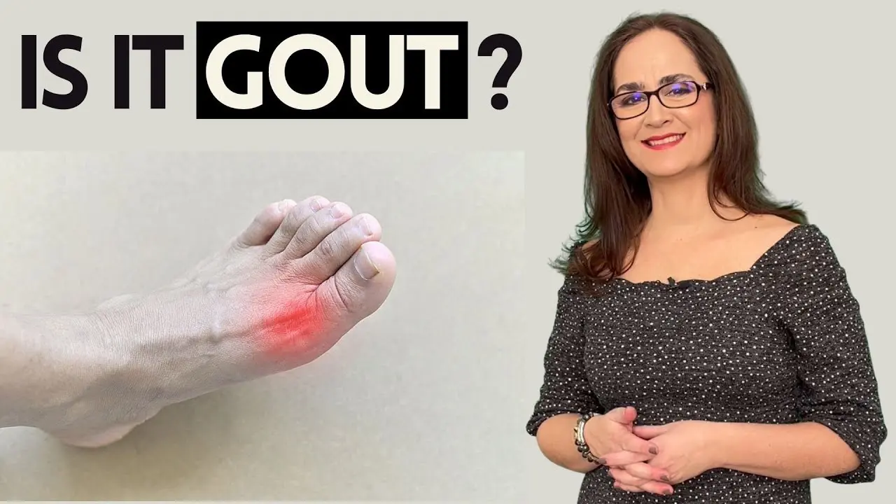 Gout &#8211; everything you need to know