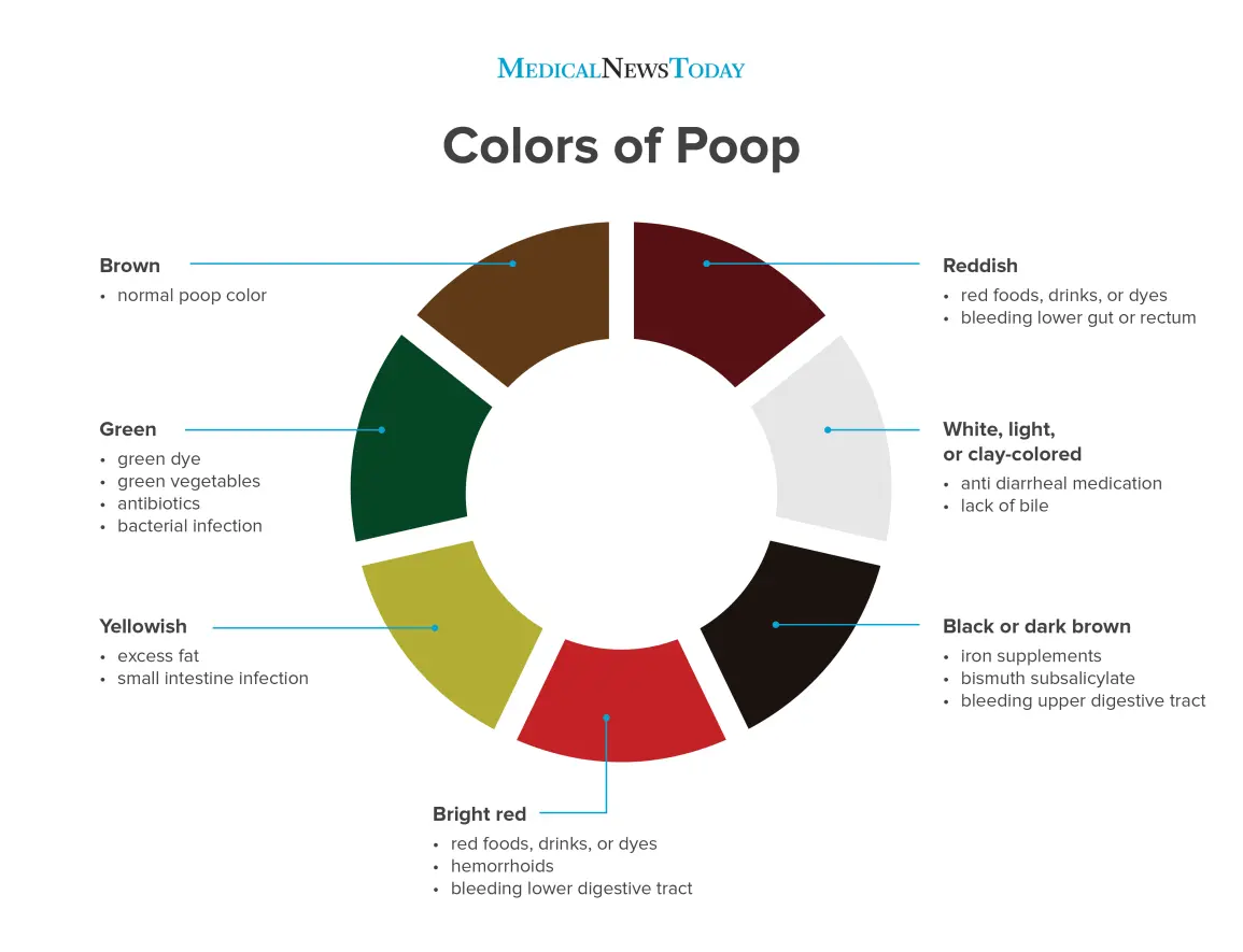 Green stool &#8211; causes of stool discoloration