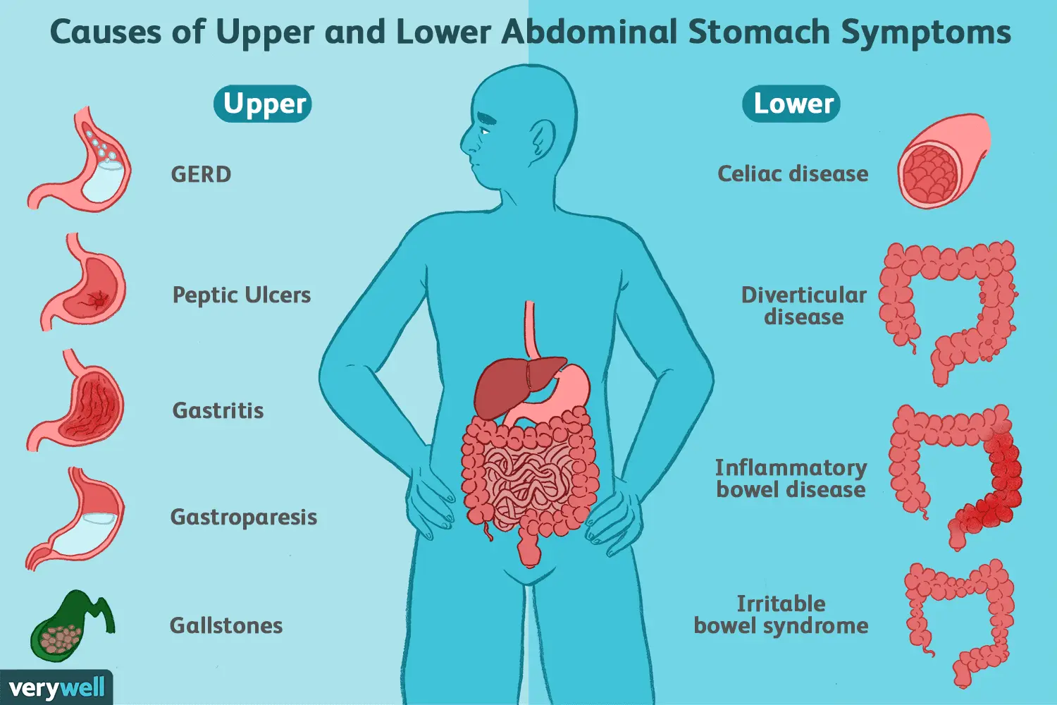 Gurgling in the belly &#8211; symptoms, causes, treatment