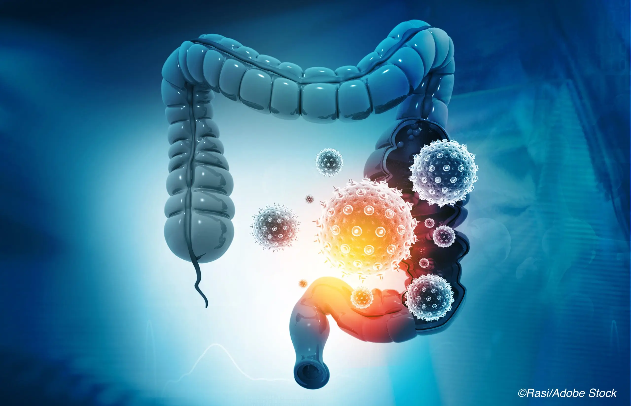 Gut microbiota transplant to fight COVID-19? Research by scientists from the Medical University of Warsaw