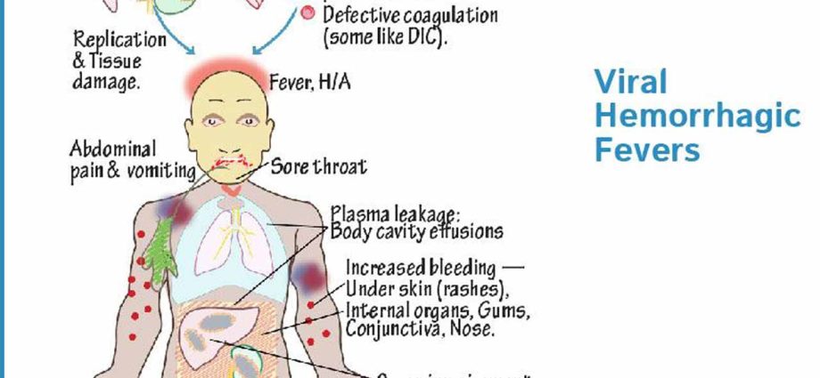 Haemorrhagic fever