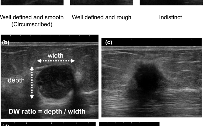 Half ultrasound &#8211; indications, norms, interpretation of results