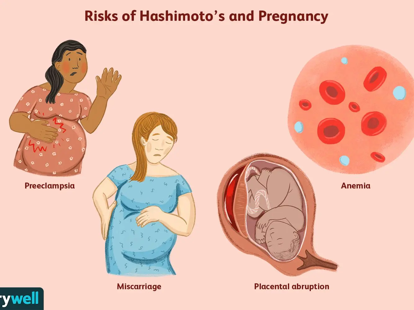 Hashimoto and pregnancy &#8211; what is a hashimoto, complications