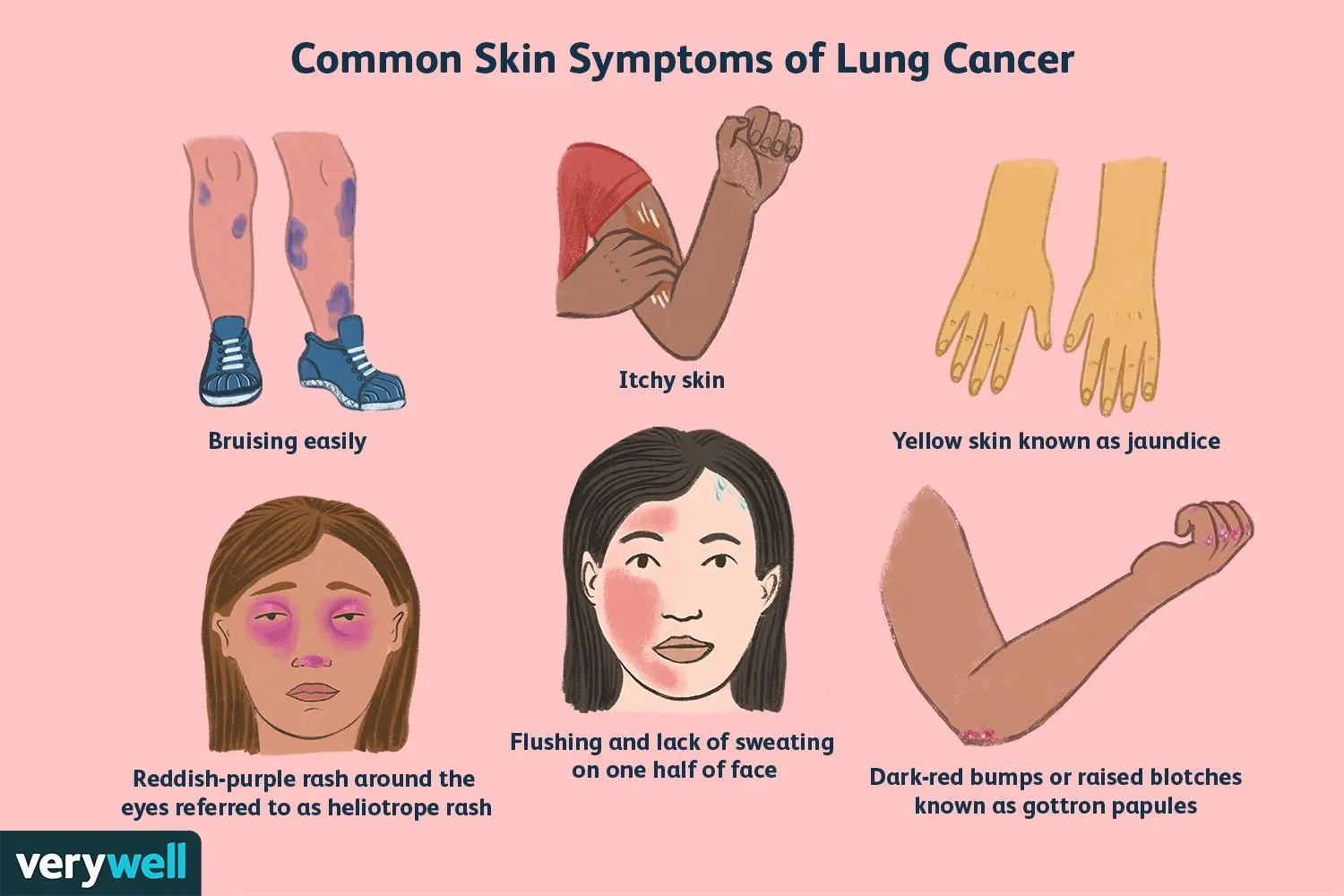 Have you noticed such changes on your face? It could be lung cancer