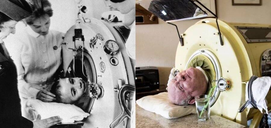 He fell ill as a child. He has been living in an iron lung for almost 70 years