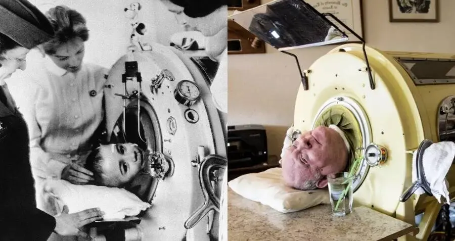 He fell ill as a child. He has been living in an iron lung for almost 70 years