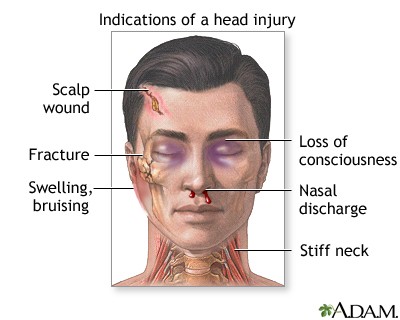 Head injuries