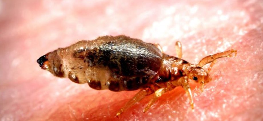 Head lice invasion