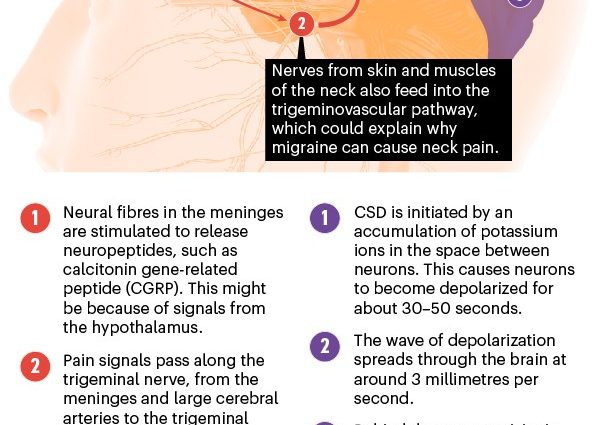 Headaches of migraine origin &#8211; symptoms, causes, treatment. How to prevent migraines?