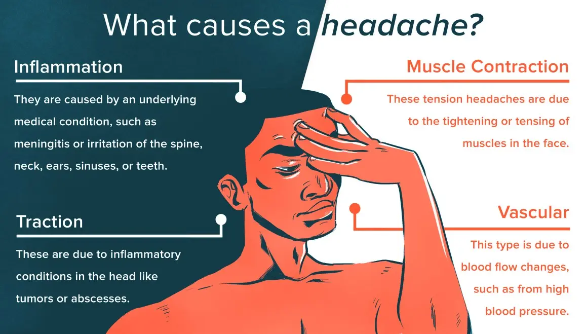 Headaches of vascular origin &#8211; causes