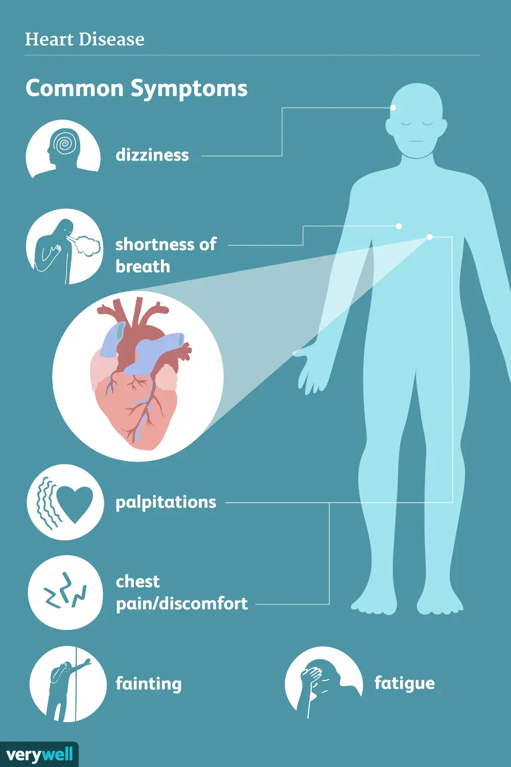 Heart disease. What symptoms are worrying?