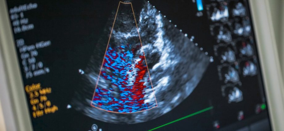 Heart echo &#8211; indications, preparation, interpretation of results. What does the examination look like?