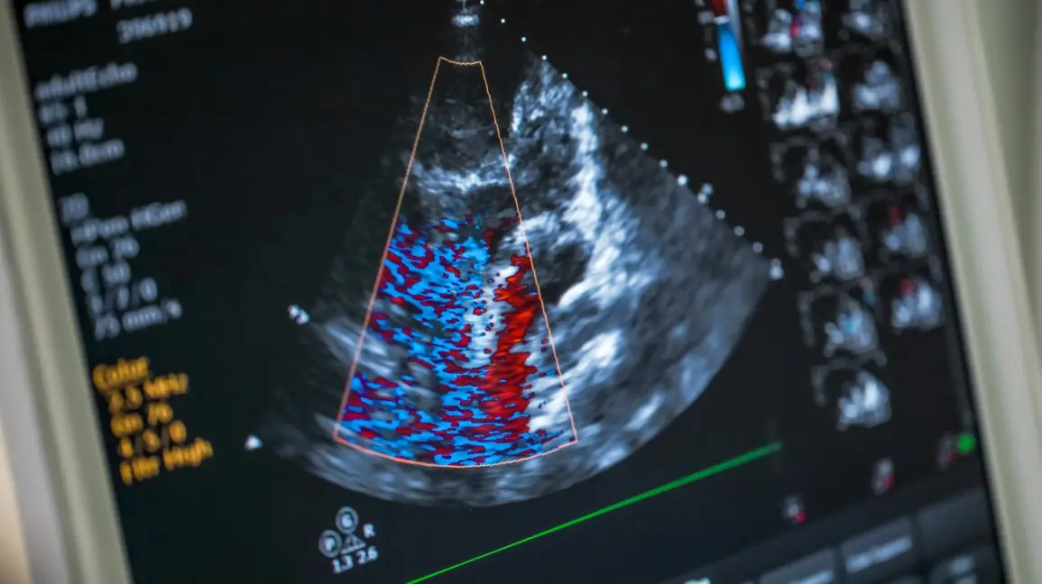 Heart echo &#8211; indications, preparation, interpretation of results. What does the examination look like?