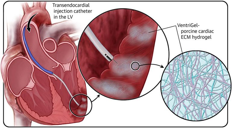 heart-muscle-cells-repair-a-damaged-heart-healthy-food-near-me