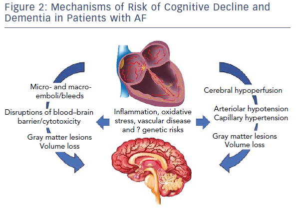 Heart rhythm disturbances increase the risk of dementia