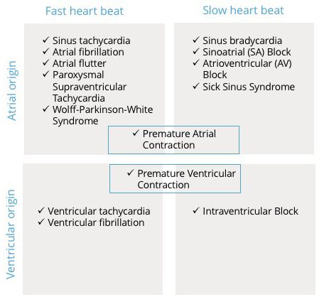 Heart rhythm disturbances &#8211; types, causes