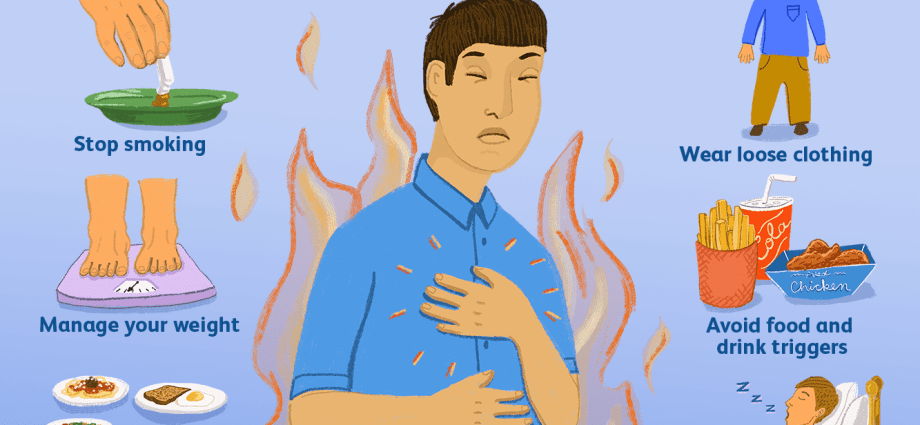 Heartburn &#8211; causes, symptoms. What about heartburn? Homemade ways.