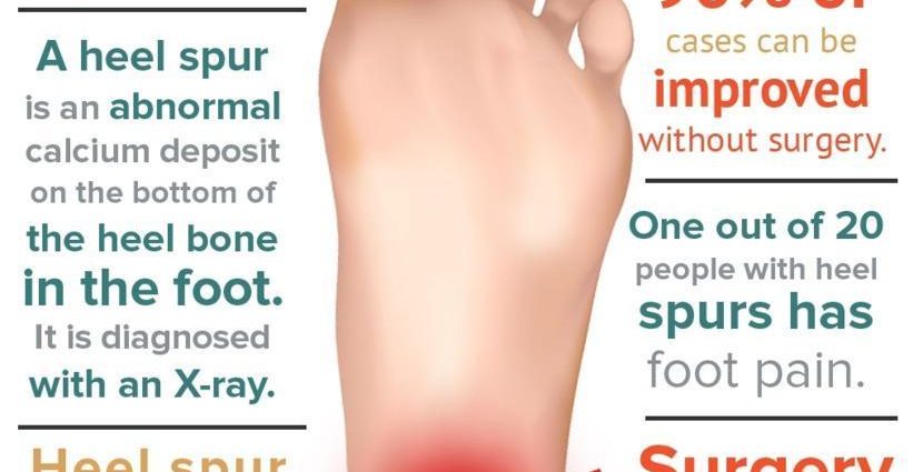 Heel spur &#8211; causes, symptoms, diagnosis, treatment. What is a heel spur?