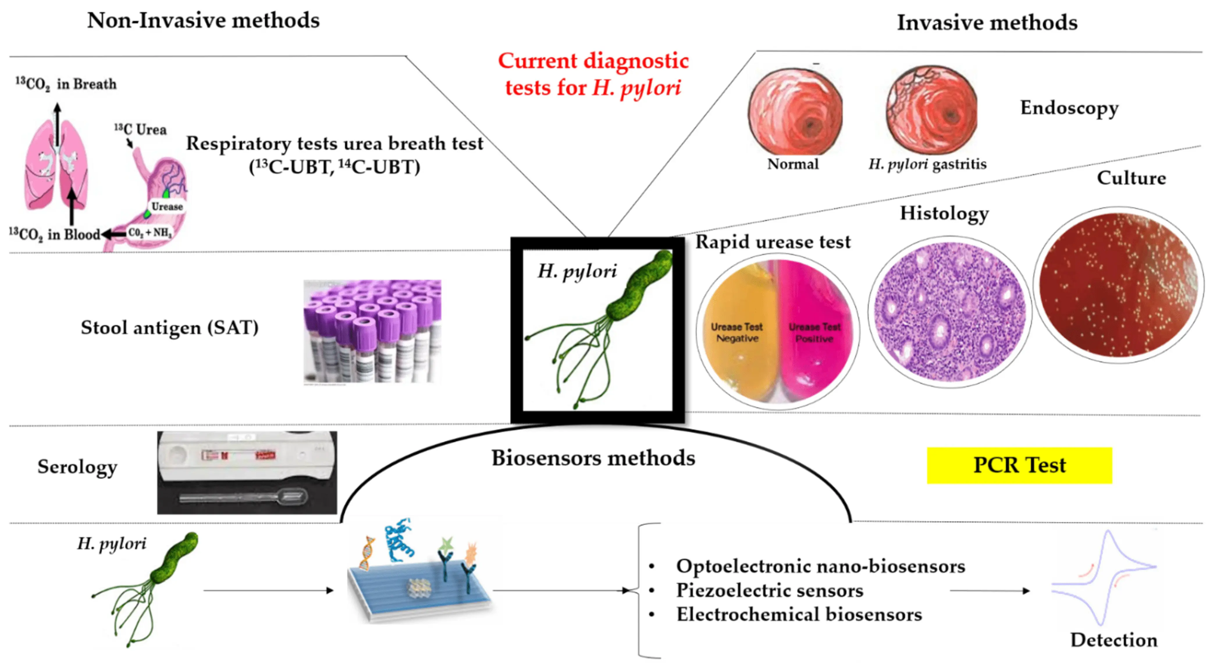 Helicobacter pylori &#8211; symptoms, diagnosis, treatment, prevention [EXPLAINED]