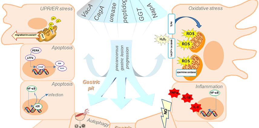 Helicobacter pylori turns off the expression of the gene that protects the stomach against cancer