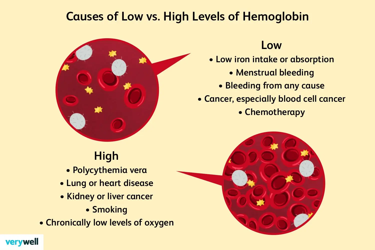 Hemoglobin &#8211; norms, testing, low and high levels of hemoglobin [EXPLAIN]