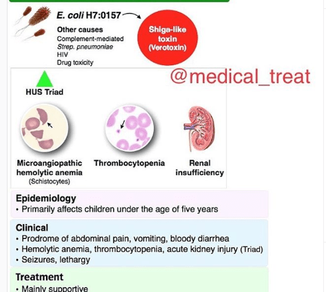 Hemolytic uremic syndrome &#8211; causes, symptoms, treatment