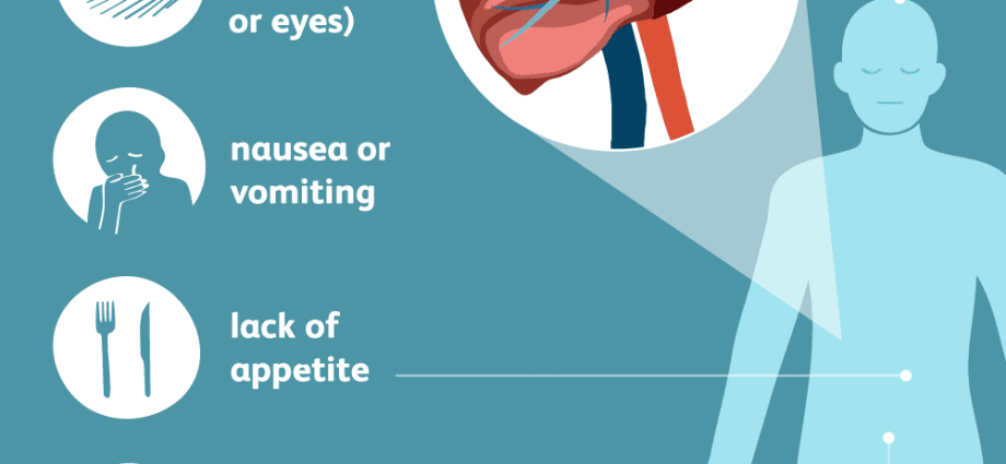 Hepatitis C &#8211; symptoms and treatment of hepatitis C