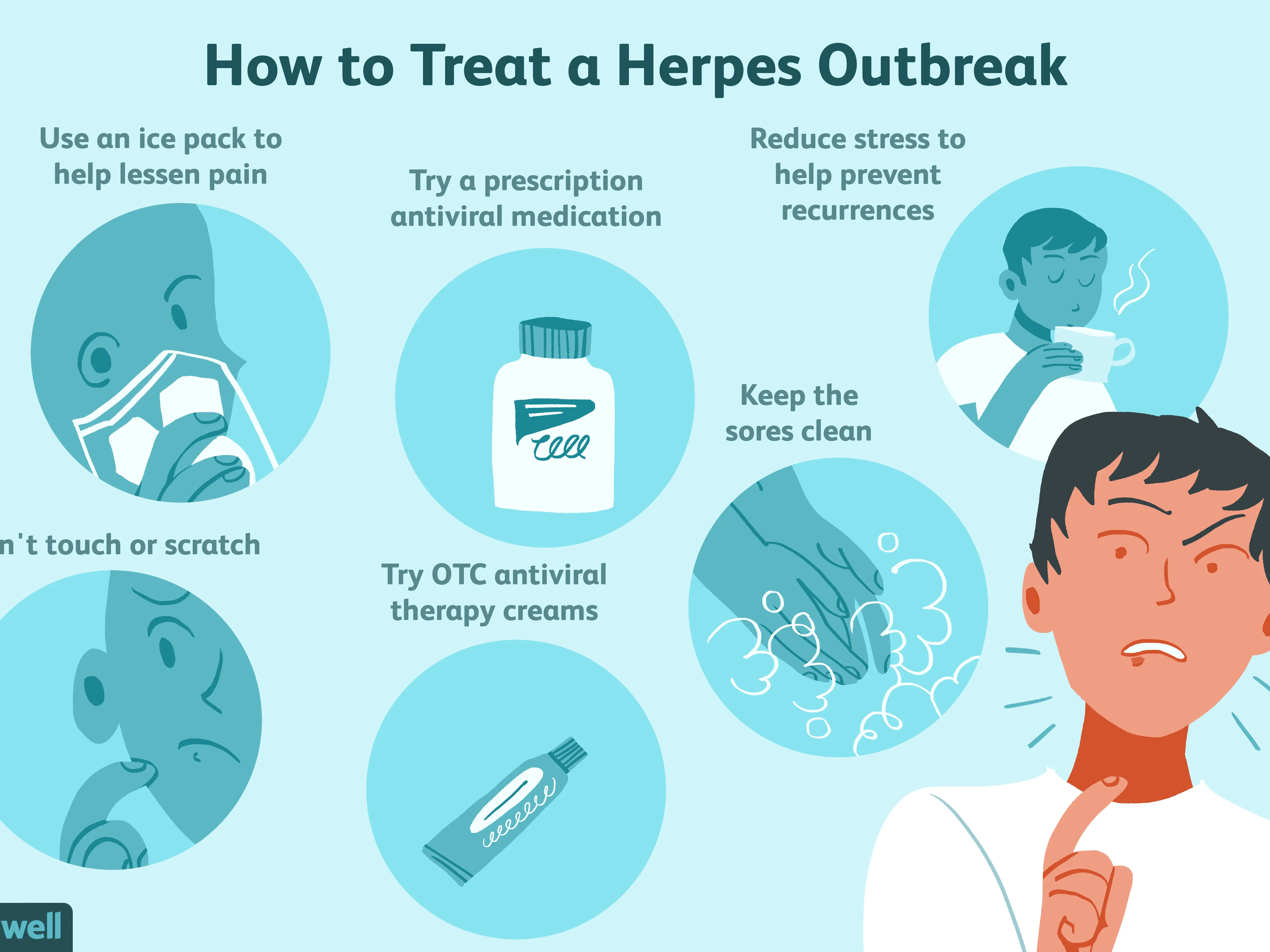 Herpes drugs &#8211; types, home remedies