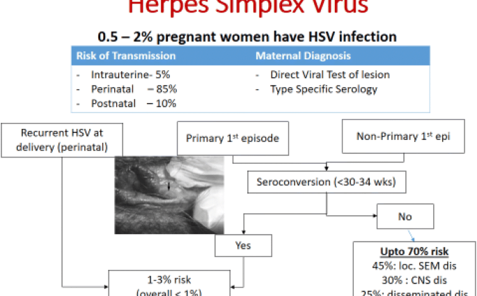 Herpes in pregnancy &#8211; symptoms and treatment