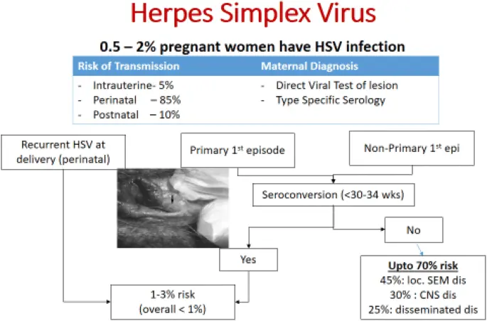 Herpes in pregnancy &#8211; symptoms and treatment